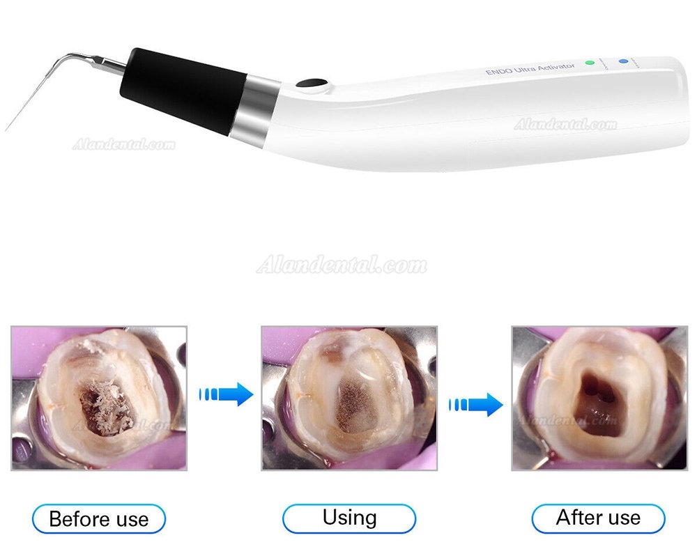 Dental Endoactivator Ultra Activator Irrigator Handpiece + Titanium Endoactivator Tip